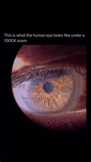 YOU’VE NEVER SEEN IT 👁️ At 1000x magnification The eye becomes an entire world Corneal cells Nerve fibers Microscopic structures All revealed in stunning detail This level of clarity can spot early signs of disease Long before symptoms ever appear The human eye isn’t just vision It’s a universe hidden in plain sight FOLLOW @xperiencetoday #xperiencetoday #eyehealth #microscopicworld #optometrylife #magnifiedbeauty