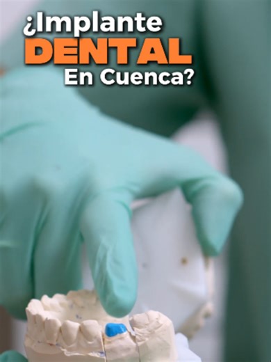 🦷📍 ¿Implante dental? Empieza con precisión. ✨ Tomografía 3D: el mapa exacto para un resultado seguro 🚨 Emergencias: 0998177786 📍 Matriz: Miguel Cordero Dávila y Cornelio Merchán | 📞 0963827543 📍 Sucursal: Eugenio Espejo y General Torres (Esq. Planta baja) | 📞 0998975140 #implante #tomografía #radiología #scan3d #cuenca_ecuador🇪🇨❤