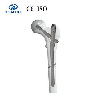 [Hot Item] Pfna Proximal Femur Nail Implant