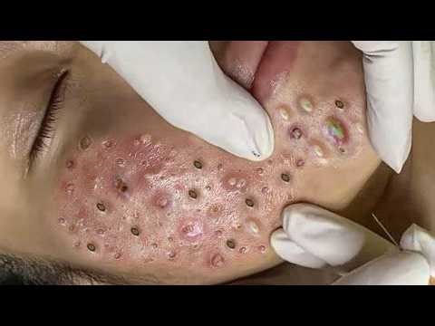 Soothing Facial Treatment for Stress Relief | Anti-Anxiety Aesthetic