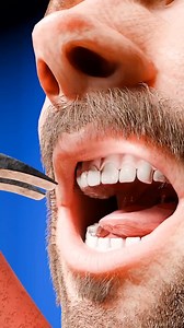 1.8M views · 4.1K reactions | Fixing A Chipped Tooth  . . . #chipped #tooth #3d #Animation #education #knowledge #facts #fb #zackdfilm #fbyシvideo #virals #reelsviralシ #facebookreel Zack D. Films Deepak Vishwakarma | Deepak Vishwakarma | Facebook