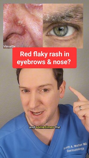 35K views · 541 reactions | What exactly is that red flaky rash on...