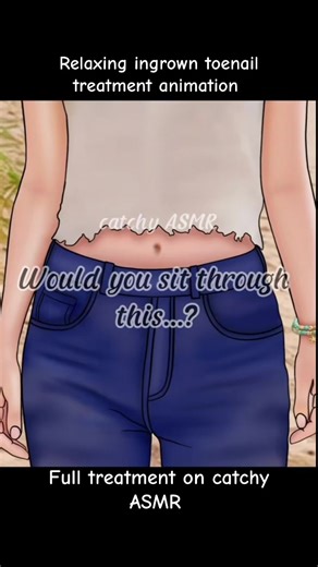 Relaxing ingrown toenail treatment animation, ASMR animation, watch full video on YouTube “catchy ASMR” #asmr #creatersearchingsight #trending #fyp #toenail