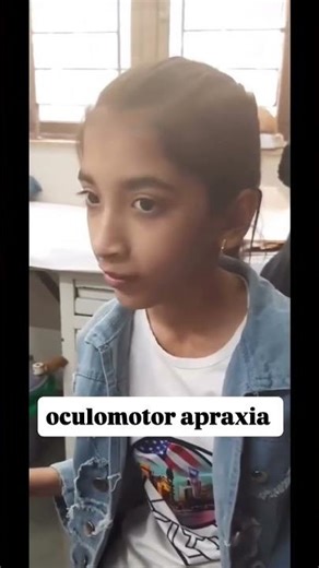 Oculomotor apraxia