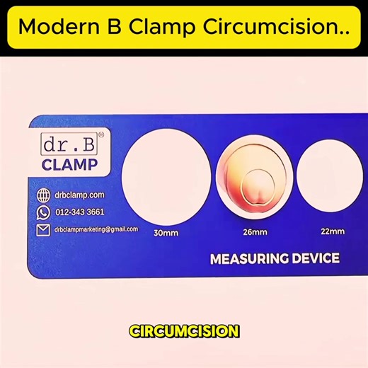 Modern B Clamp Circumcision #fyp #foryoupage #health #newtrending #circumcision