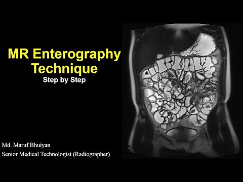MR Enterography Technique Step by Step | Protocols | Planning | MR Enterogram Procedure |Preparation