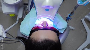 Young woman with an expander in mouth and red protective glasses getting UV whitening at the dentist's office by an ultra violet machine.