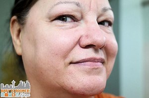 Como usar o DermaWand?