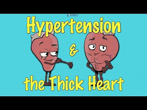Left Ventricular Hypertrophy (LVH) and Hypertension