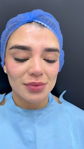 6.8K views · 25 reactions | ¿Conoces el procedimiento de Foxy Eyes? ✨...