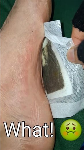 I Tried This on My Feet for 1 Night… The Result 😳