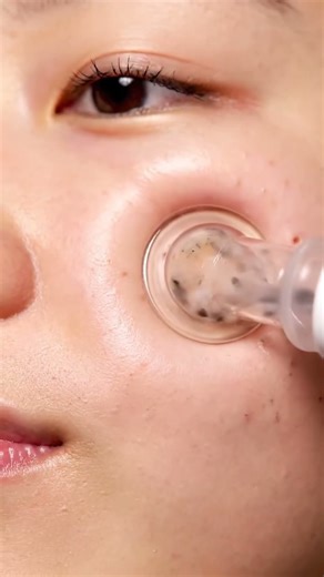 Blackhead Extraction Boost — Clear Skin