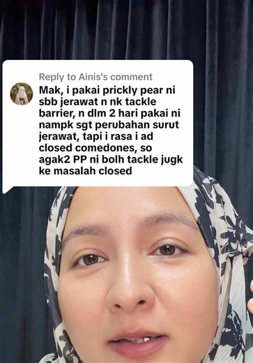 Replying to @Ainis tambah toner atau buat extraction ya, or maybe both! Thann you for your feedback