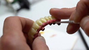 1.1M views · 5.7K reactions | Here's how people are getting dental implants for a fraction of the old prices. | Nation.com | Facebook