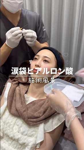 【大人気！涙袋ヒアル】実際の施術の様子をお見せします💉✨ #美容 #美容皮膚科 #beauty #涙袋ヒアルロン酸 #涙袋