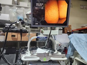 OLYMPUS GF-UM2000 Ultrasound Gastroscope