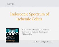 Endoscopic Spectrum of Ischemic Colitis