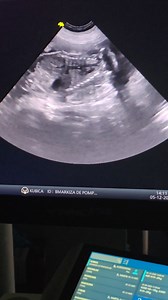 39 reactions | Tak pięknie rosną maleństwa B'MARKIZA DE POMPADOUR Złota Magnolia I SONG TO SING Harmony of life Przyjdą na świat przed samymi Świętami Bożego Narodzenia | Aleksandra Kubica | Facebook