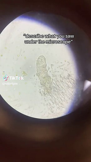 wait I loved this lab tho🥹 #bio #college #fyp | water bear