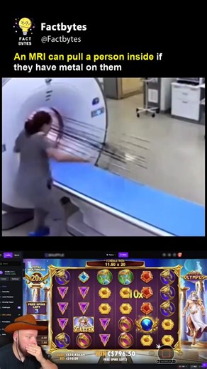 Factbytes on Instagram: "An MRI machine isn’t just loud—it’s incredibly powerful. 🧲 Even small metal objects can turn into dangerous projectiles when the magnet is active. That’s why strict safety checks are vital before any scan. This isn’t a myth; it’s real science and real risk. Always remove metal and follow medical instructions to stay safe. ⚠️ #MRI #medicalfacts #science #healthsafety"
