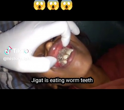 Dental Procedure Insights: Understanding Teeth and Gums