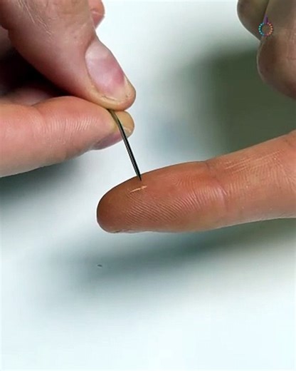 The easiest splinter removal you’ll see today