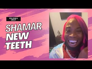 Shamar pops out with New Teeth