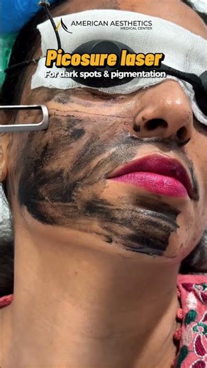 How PicoSure Laser Removes Tattoos Faster Than Ever | Next Health & Aestheitcs