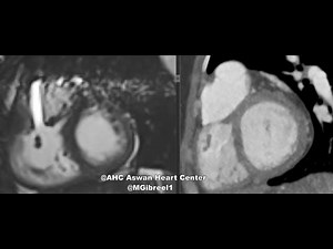DCRV MRI& CTA