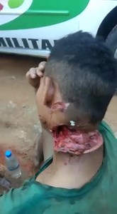 Man with chopped neck survives
