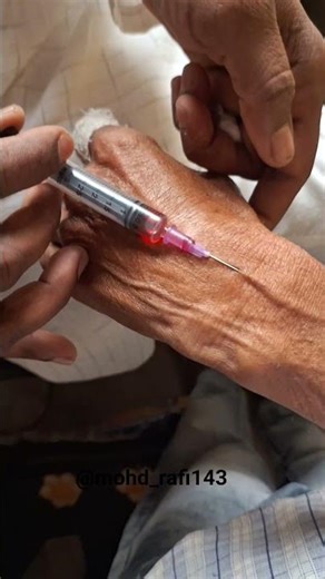 How to Insert iv Injection Technique #nursing #reels #project #trending #short