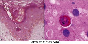 Verschil tussen autolyse en apoptose | Autolysis vs Apoptosis - Wetenschap en natuur 2025
