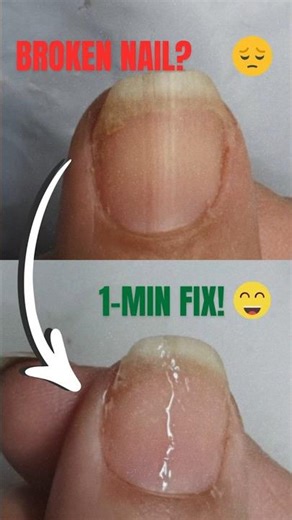Broken Nail Try This Tea Bag Trick! 💅