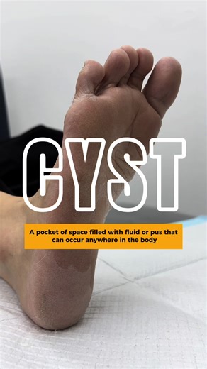 Mr Feetspo on TikTok