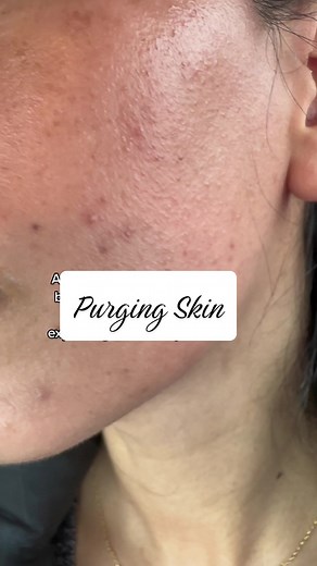 ✨ S H R U T I ✨ on TikTok