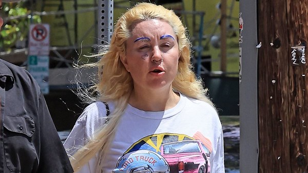 Amanda Bynes flaunts eyebrow overhaul and shrinking Ozempic frame