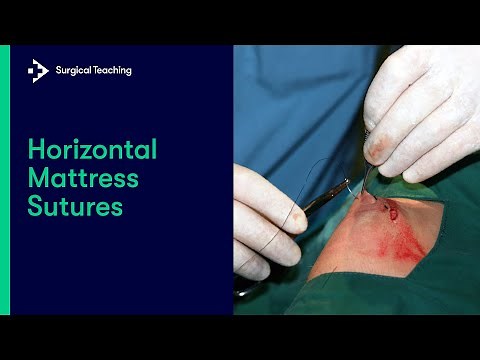 Horizontal Mattress Sutures