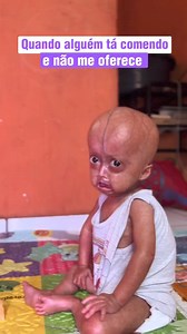 A vida é complica desde de cedo pro crente 😂 #eliseeloa #progeria #gemeasrara #viral | Max Delaney