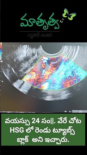 Saline sonography, also known as saline infusion. #gyn #obgyn #obgyndoctor #gynecology #obgyns