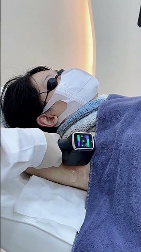 Moonlight AI Laser Pro: Smart Hair Removal Made Simple! 🤖✨