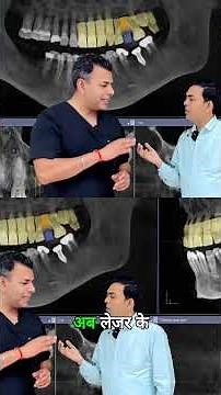 🦷 Laser Wisdom Tooth Removal by Dr. Rajat Sachdeva | Delhi Dentist Painless Dentistry