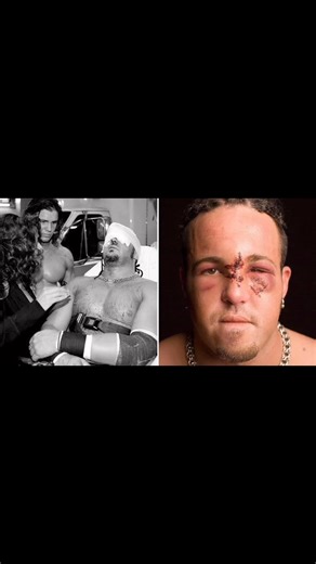 19 years ago today, WWE presented Armageddon live from Richmond, Virginia! Although it wasn’t the main event, the show is most remembered for one of the most graphic and frightening injuries in WWE history. During a tag team ladder match featuring MNM, Paul London & Brian Kendrick, The Hardy Boyz, and William Regal & Dave Taylor, Joey Mercury suffered a devastating facial injury. Mercury, teaming with Johnny Nitro, was on the receiving end of a ladder spot gone wrong when Jeff Hardy leapt onto a