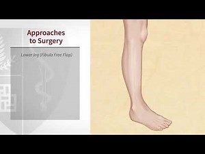 Understanding Reconstructive Surgery for Head & Neck