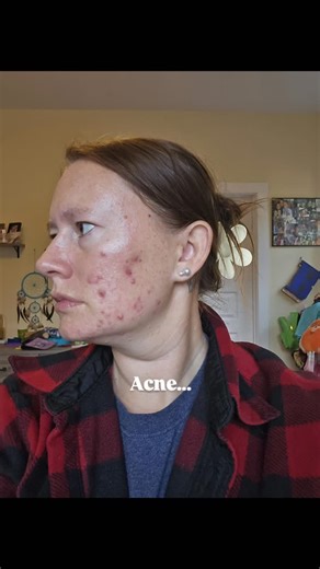 Amber Oliver | Holistic Skincare on Instagram: "✨ The power of Hydroxytyrosol in skincare ✨ This antioxidant powerhouse—naturally derived from olives—has one of the highest ORAC scores (oxygen radical absorbance capacity) of any known compound. 💪🏽 Why it matters for your skin: 🌿 Neutralizes free radicals that accelerate aging 🌿 Helps protect collagen + elastin for firmer, bouncier skin 🌿 Supports a healthy skin barrier and natural glow 🌿 Gentle yet powerful—perfect even for sensitive skin 