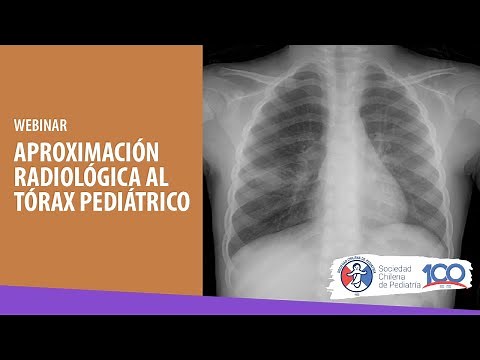 WEBINAR "RADIOLOGICAL APPROACH TO THE PEDIATRIC THORAX"