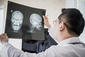 The Anatomy of the Frontal Bone