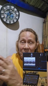 The reason why i left my bike in Tagaytay: A horrible experience that solidify my perspective in life. | Nelson Razon Tingin