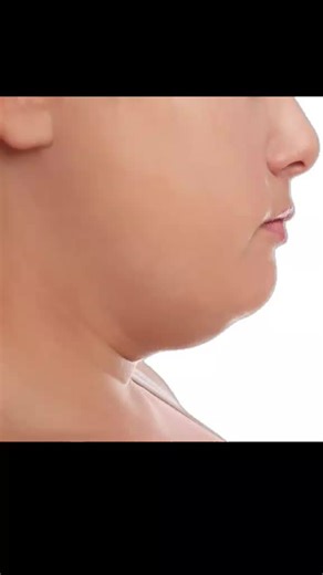 El físico sí importa: Reflexiones sobre la autoaceptación