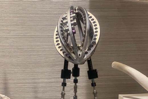 Alex Smith’s wife had his leg brace made into a Lombardi Trophy, locks up Spouse of the Year in January