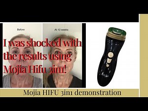 Mini Hifu 3in1 Skin Tightening at Home | Mini Hifu tutorial using three modalities | Mojia Hifu 3in1